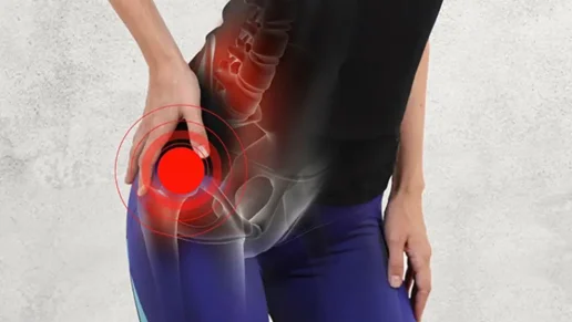The Many Causes of Hip Pain