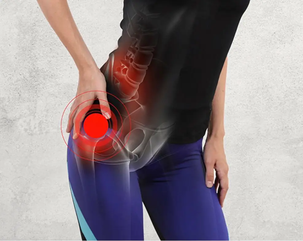 The Many Causes of Hip Pain