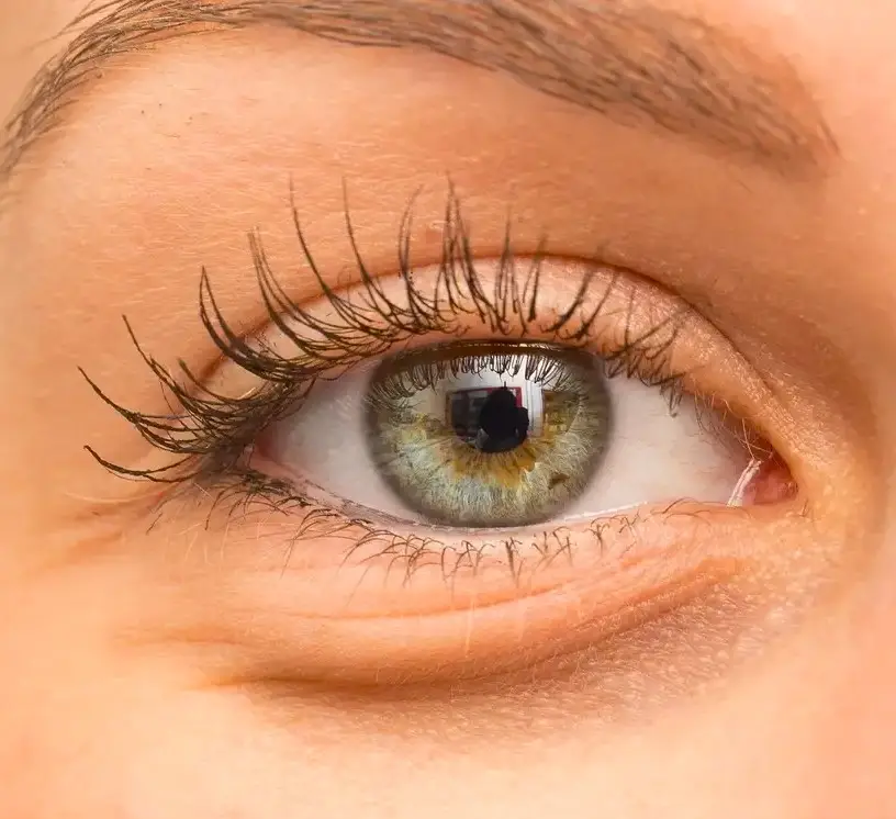 Those Under-Eyes Bags